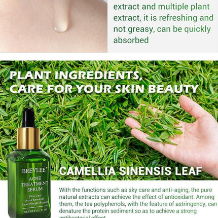 Acne Treatment Serum Facial Repair Oil