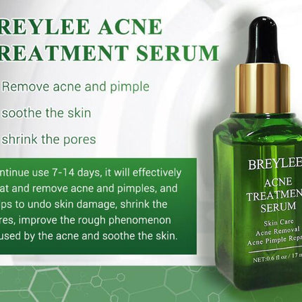 Acne Treatment Serum Facial Repair Oil